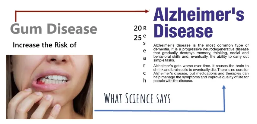 can-gum-disease-increase-your-risk-of-alzheimer-disease?-what-science-says-in-2025