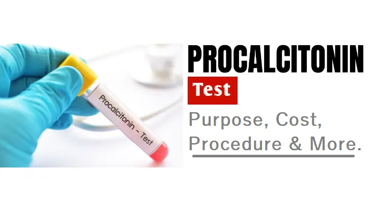 the-procalcitonin-test:-your-ally-in-infection-detection