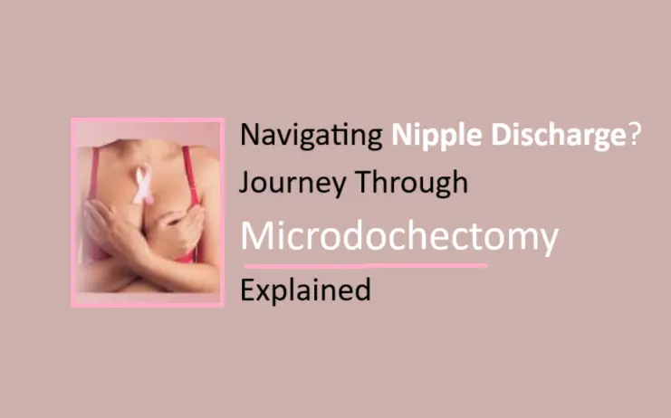 navigating-nipple-discharge?-microdochectomy-explained