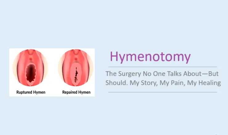 hymenotomy:-the-surgery-no-one-talks-about—but-should.-my-story,-my-pain,-my-healing