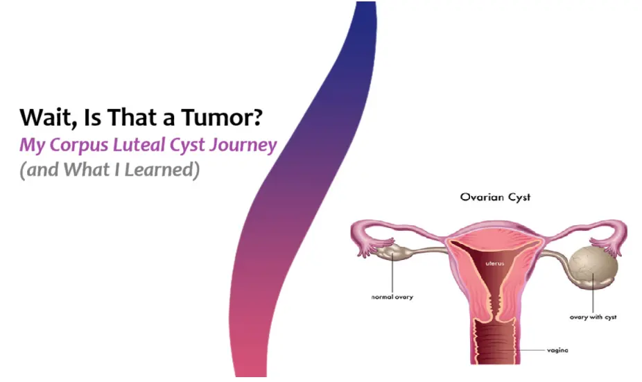 wait,-is-that-a-tumor?-my-corpus-luteal-cyst-journey-(and-what-i-learned)