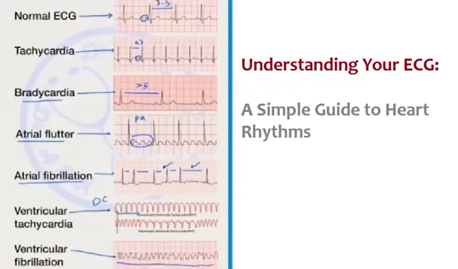 decoding-your-ecg:-a-simple-guide-to-heart-rhythms