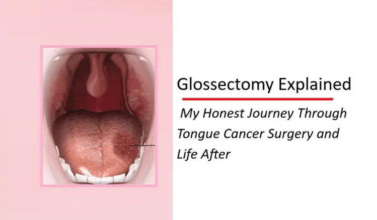 glossectomy-explained:-my-honest-journey-through-tongue-cancer-surgery-and-life-after