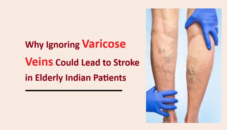 why-ignoring-varicose-veins-could-lead-to-stroke-in-elderly-indian-patients