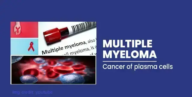 multiple-myeloma-with-symptoms-causes-prognosis-and-treatment-options