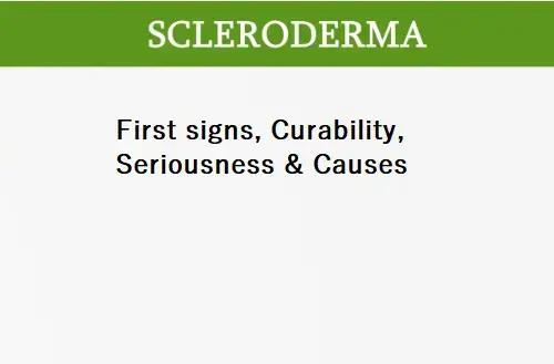 first-signs-and-curability-of-scleroderma