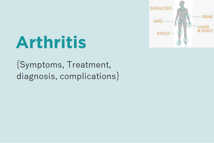 what-is-arthritis-symptoms-treatment-diagnosis-and-complications
