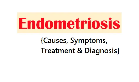 know-about-endometriosis-with-causes-symptoms-diagnosis-and-treatment