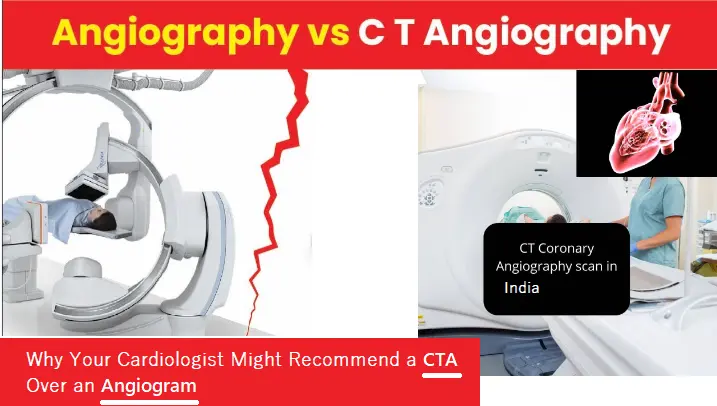 why-your-cardiologist-might-recommend-a-cta-over-an-angiogram?