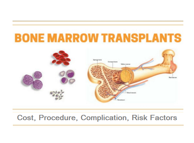your-guide-to-bone-marrow-transplant-in-india