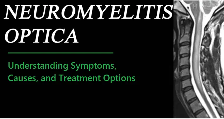 neuromyelitis-optica-(nmo):-understanding-symptoms,-causes,-and-treatment-options