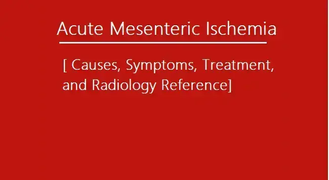 mesenteric-ischemia:-symptoms-and-treatment-with-essential-insights-for-radiologists