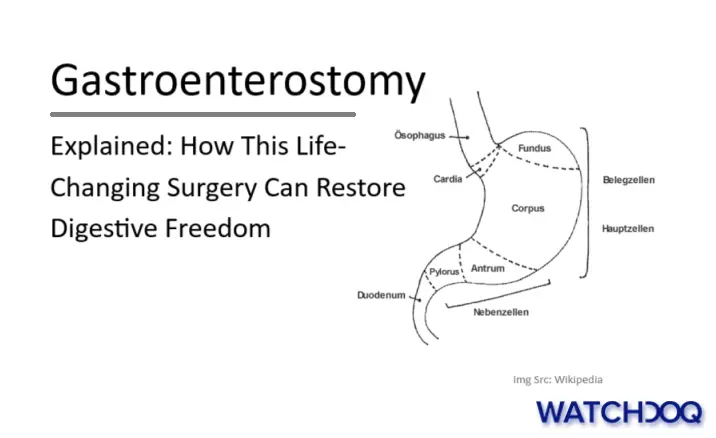 gastroenterostomy-explained:-how-this-life-changing-surgery-can-restore-digestive-freedom