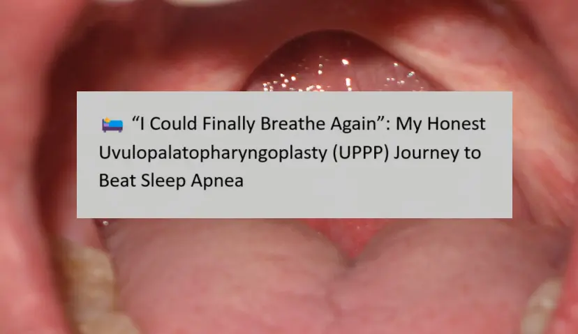 uvulopalatopharyngoplasty-(uppp)-journey-to-beat-sleep-apnea