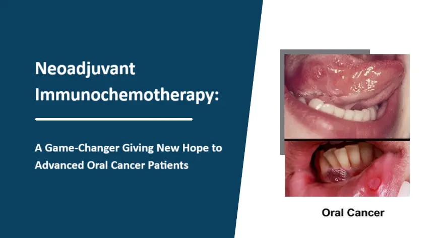 neoadjuvant-immunochemotherapy:-a-game-changer-giving-new-hope-to-advanced-oral-cancer-patients