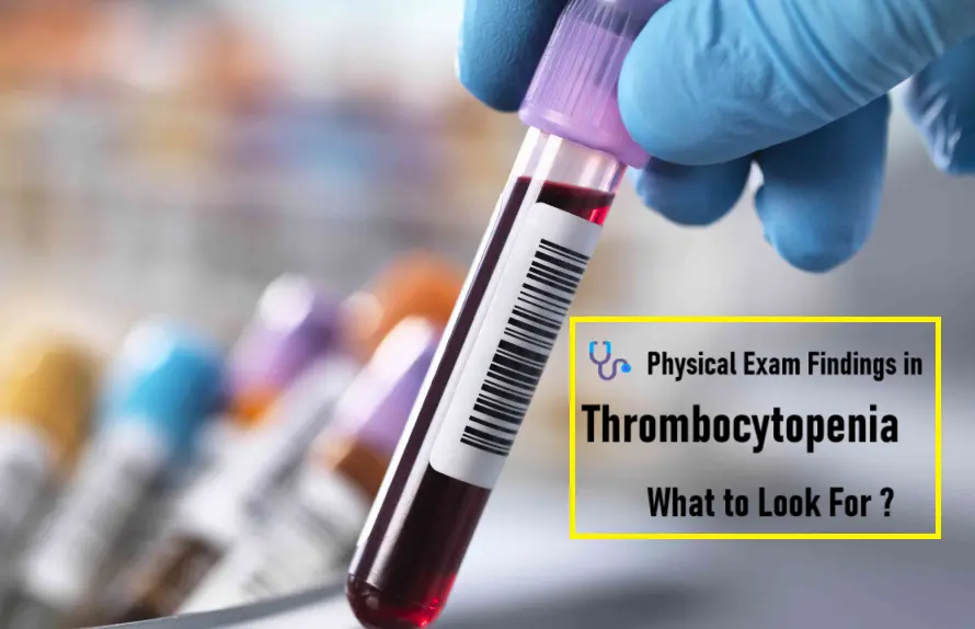 5-physical-exam-findings-in-thrombocytopenia:-what-to-look-for