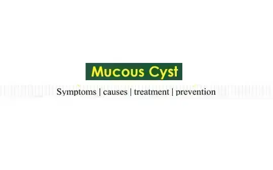 treatment-options-for-mouth-cyst-or-mucocele-in-kolkata