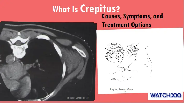 what-is-crepitus?-understanding-the-causes,-symptoms,-and-treatment-options