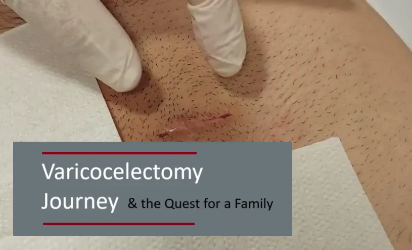varicocelectomy-and-male-infertility