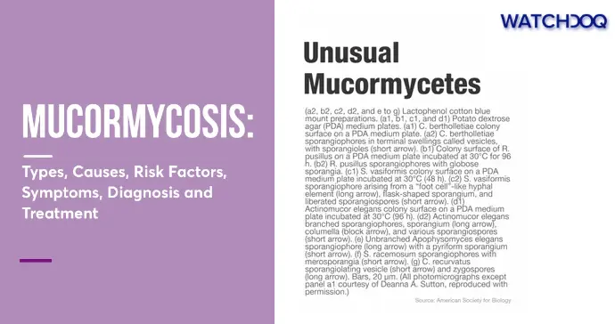 mucormycosis:-a-silent-threat-(symptoms,-diagnosis-and-treatment)