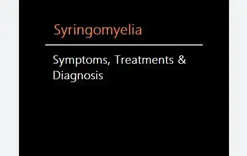 symptoms-treatments-and-diagnosis-of-syringomyelia