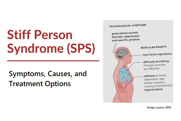 understanding-stiff-person-syndrome:-symptoms,-causes,-and-treatment-options