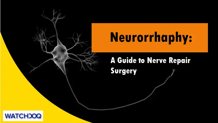 A Stitch in Time: Understanding NeurorrhaphyNavigating Nerve Repair SurgeryHave you ever heard of neurorrhaphy? It's a fascinating surgical procedure that involves stitching together severed nerves.