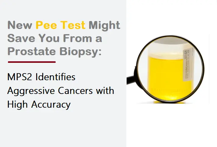 prostate-cancer:-could-a-simple-pee-test-replace-a-painful-biopsy?