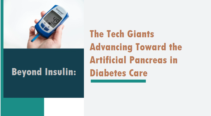 The Tech Giants Advancing Toward the Artificial Pancreas in Diabetes Care