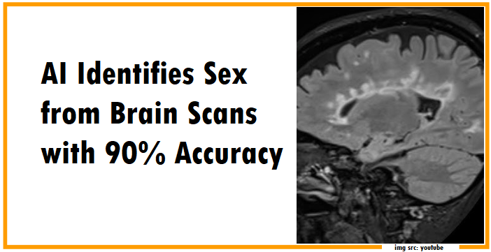 Decoding Gender Differences: AI Identifies Sex from Brain Scans with 90 Percent Accuracy